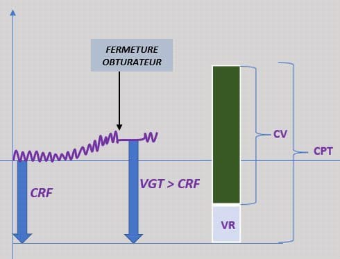 Mesures CRF VGT