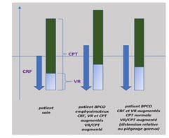 Mesures CRF VGT