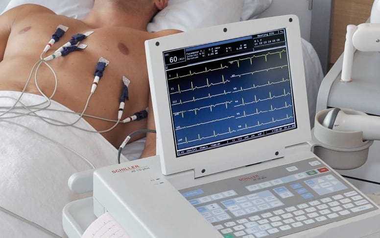 Réalisation d'un électrocardiogramme