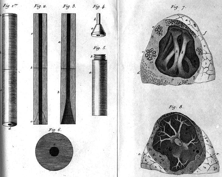 Coupe d'un stethoscope de Laennec