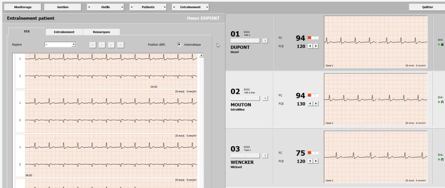 Le thérapeute affiche l'ECG en un clic et génère un PDF si besoin.