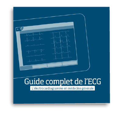 Guide ECG