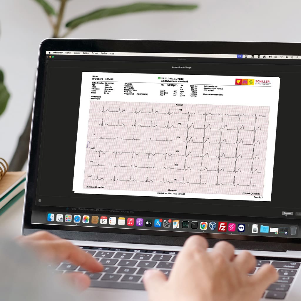 ECG numérisé