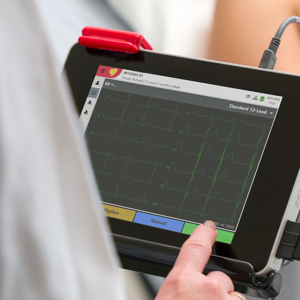 ECG repos tracé